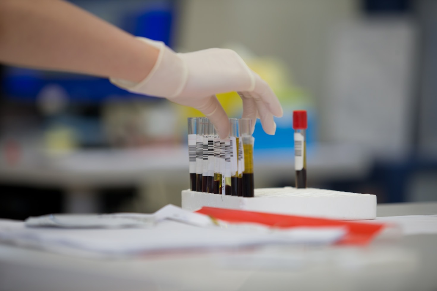 Why Blood Health Is Key to Overall Wellness